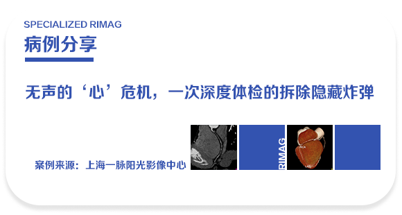 典型病例 | 无声的「心」危机:一次深度体检,为他拆除了即将引爆的「血管炸弹」