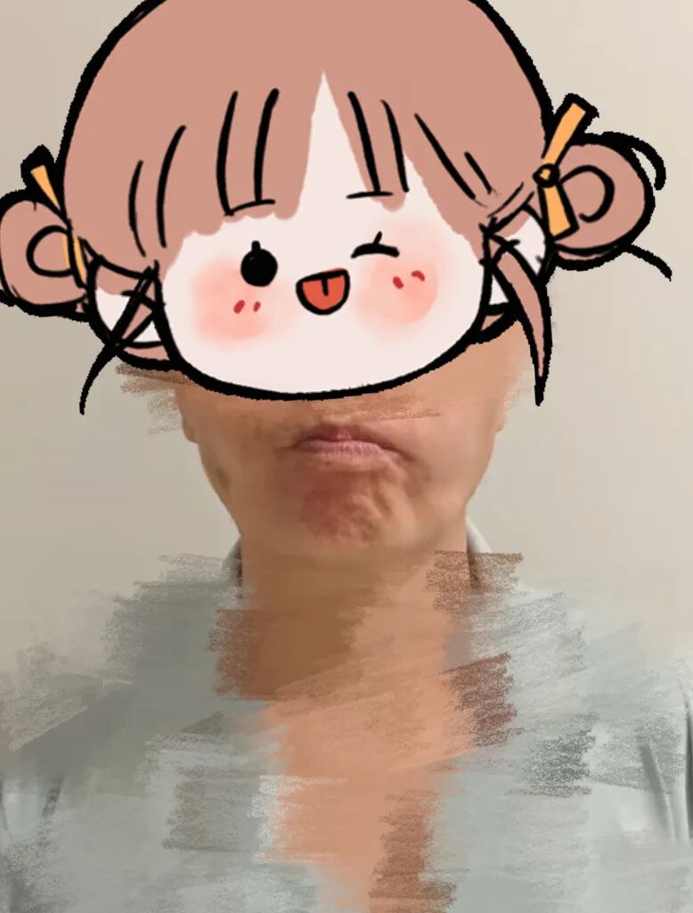 头晕走路不稳,不是颈椎病?真相让她崩溃了