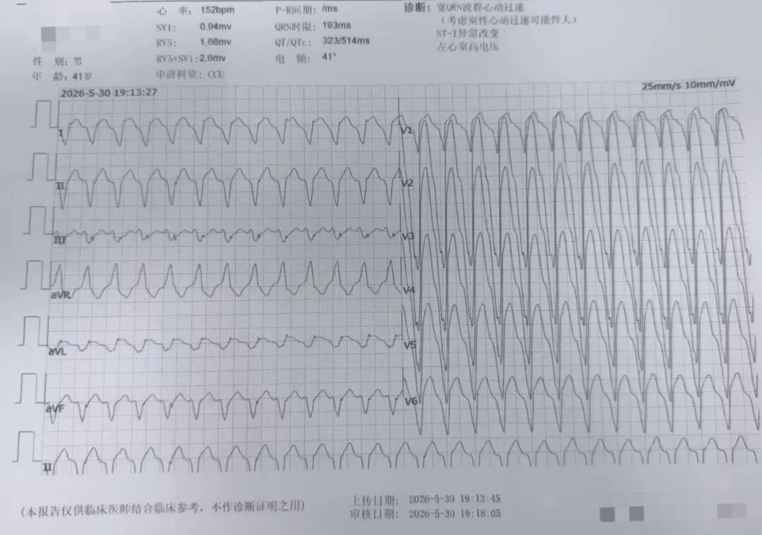 国文医院首例 ICD 植入手术圆满落地!体内「心脏救生舱」筑牢猝死防护墙