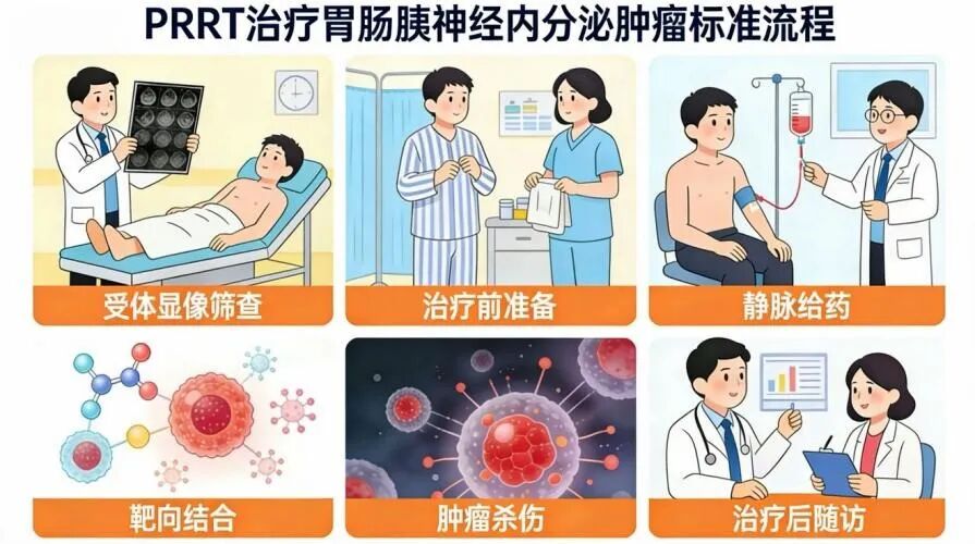 胃肠胰神经内分泌肿瘤:偷偷潜伏的「杀手」