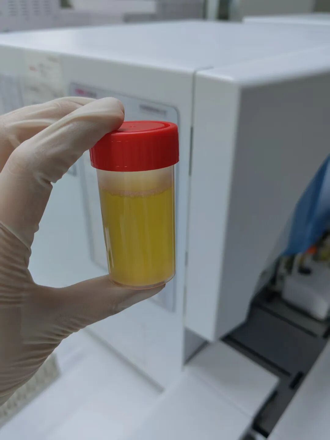 一分钟看懂尿常规化验单!箭头、加减号再也不用慌