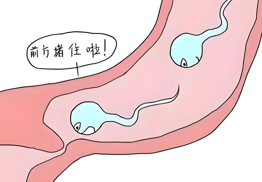 老公无精症,我却怀孕了