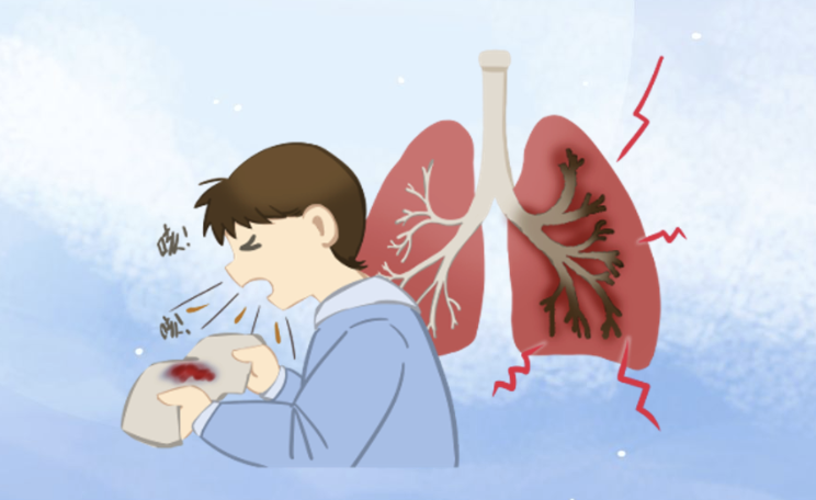 用药水火不容、多家医院拒收!七旬老人咯血遇肺栓塞,最后一搏绝处逢生