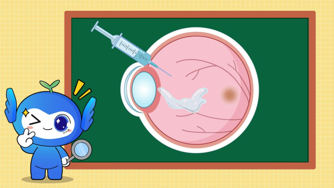 眼内注药到底是什么体验?
