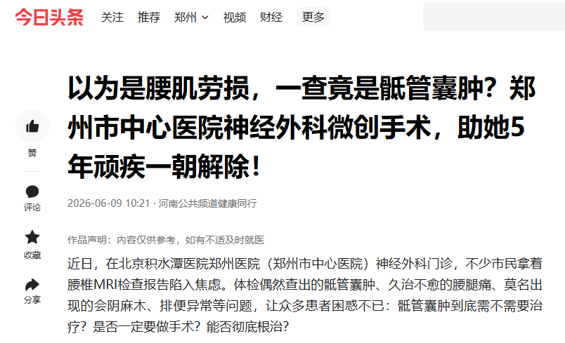 以为是腰肌劳损,一查竟是骶管囊肿?郑州市中心医院神经外科微创手术,助她5年顽疾一朝解除!