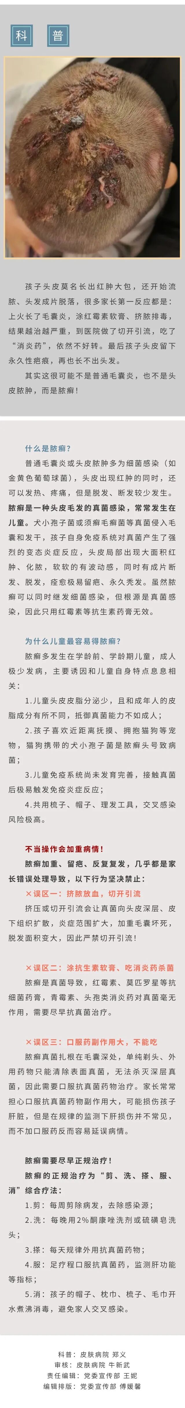 头皮红肿起大包、流脓还掉发！警惕脓癣，不能切开引流
