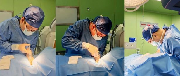 微创除痛、稳固颈椎！骨水泥技术精准攻克颈椎癌痛