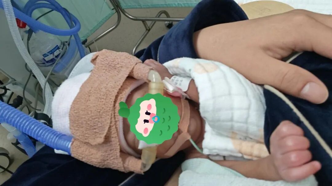 巴掌大、透明皮肤、一瓶水的重量……这些「迷你宝宝」如何闯过生命第一关?