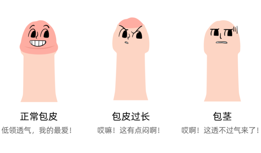 别把「小男题」拖成「大烦恼」 | 男孩的包皮到底割不割?这些情况才真需要!