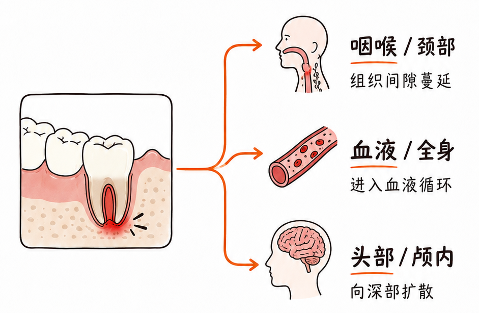 牙痛不是病?有些牙痛,真能要命!