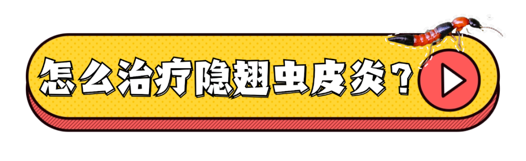 隐翅虫又来了!有人脸上破溃,有人皮肤化脓