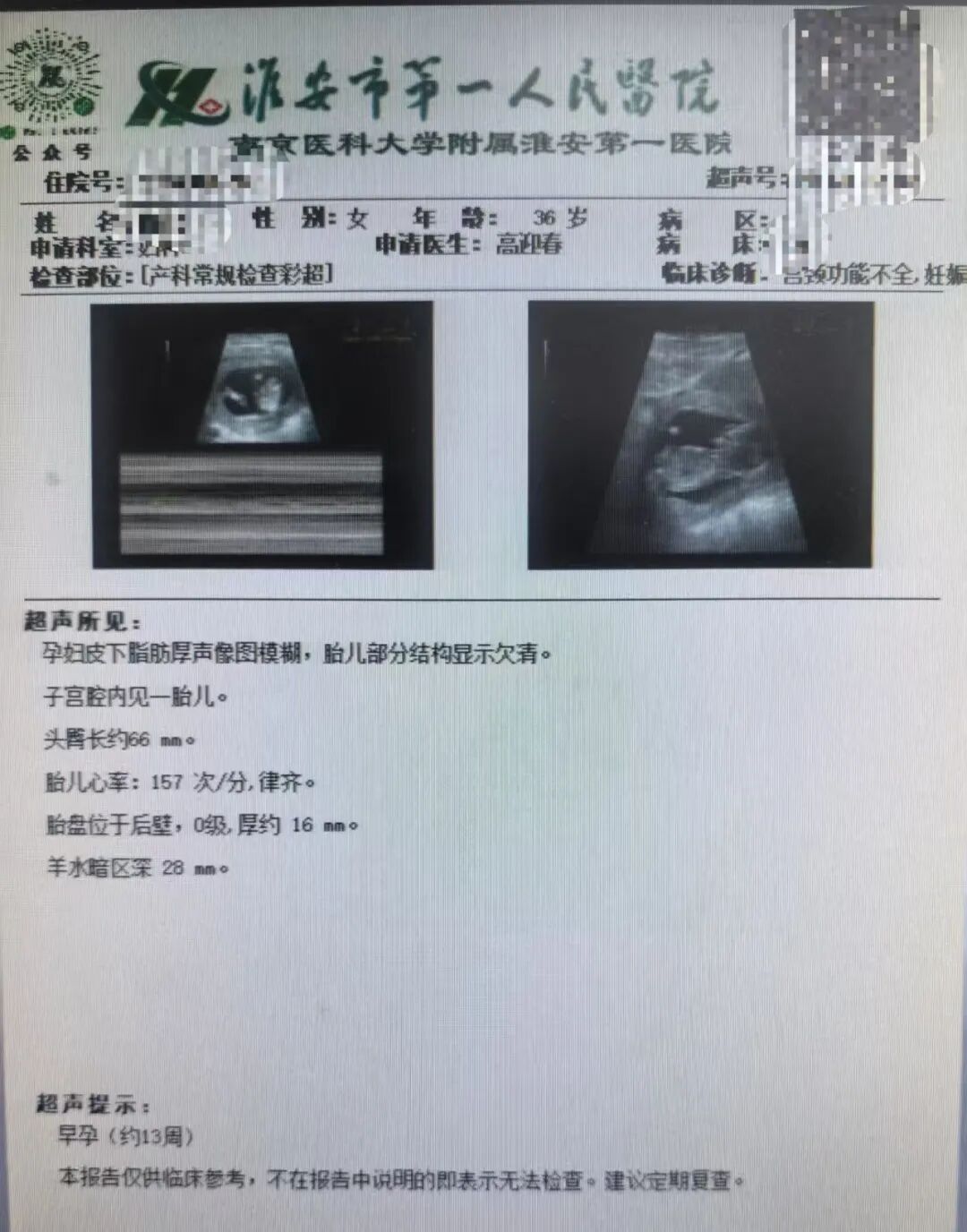 首例!淮安市一院完成机器人辅助孕中期宫颈环扎术 守护反复流产孕妈