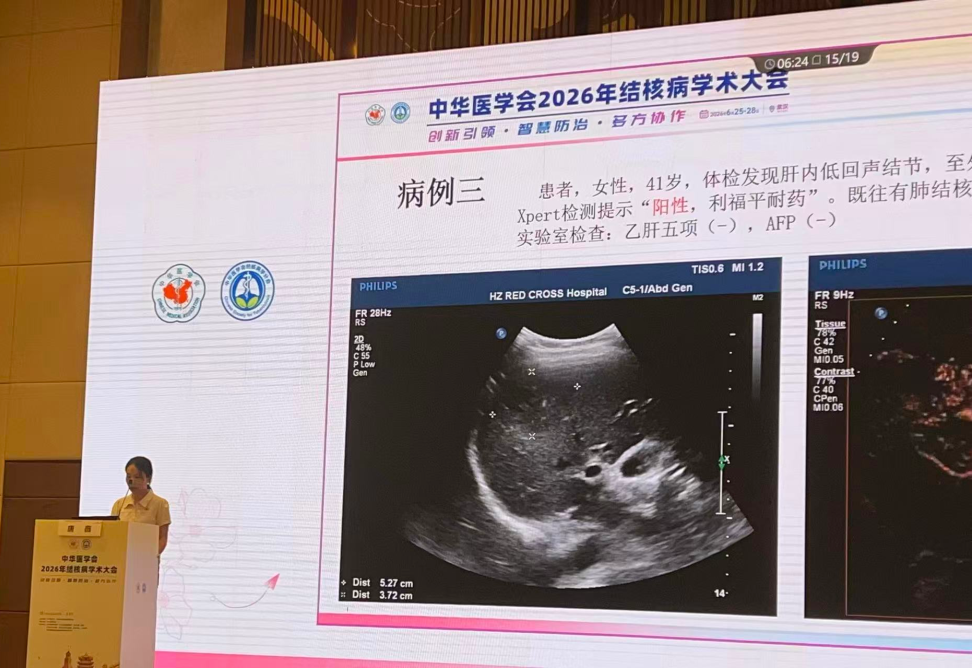 江城论道 学术赋能 | 我院亮相2026年全国结核病学术大会