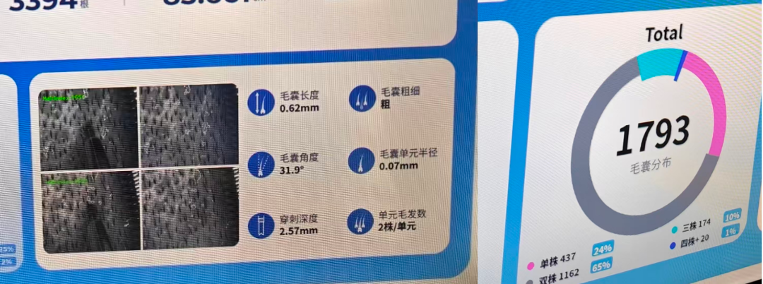 AI植发机器人大师班在郑州落幕