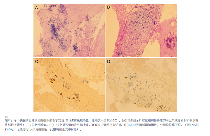 河北一洲肿瘤医院康静波教授团队在国际权威SCI期刊《Frontiers in Medicine》发表重要病例报告