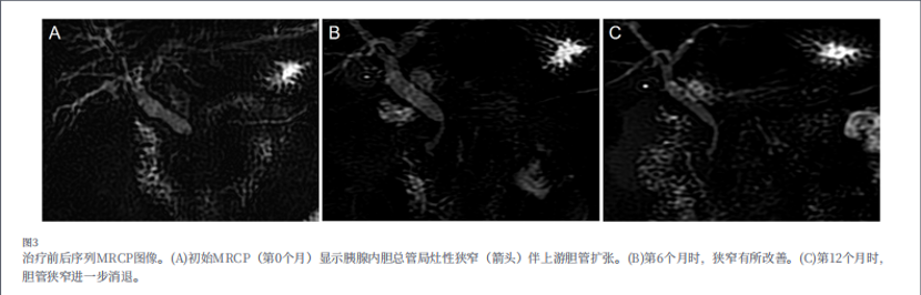河北一洲肿瘤医院康静波教授团队在国际权威SCI期刊《Frontiers in Medicine》发表重要病例报告