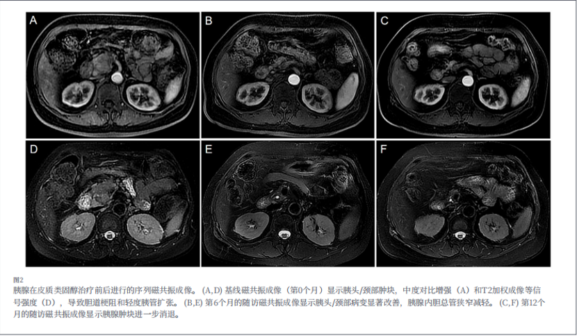 河北一洲肿瘤医院康静波教授团队在国际权威SCI期刊《Frontiers in Medicine》发表重要病例报告