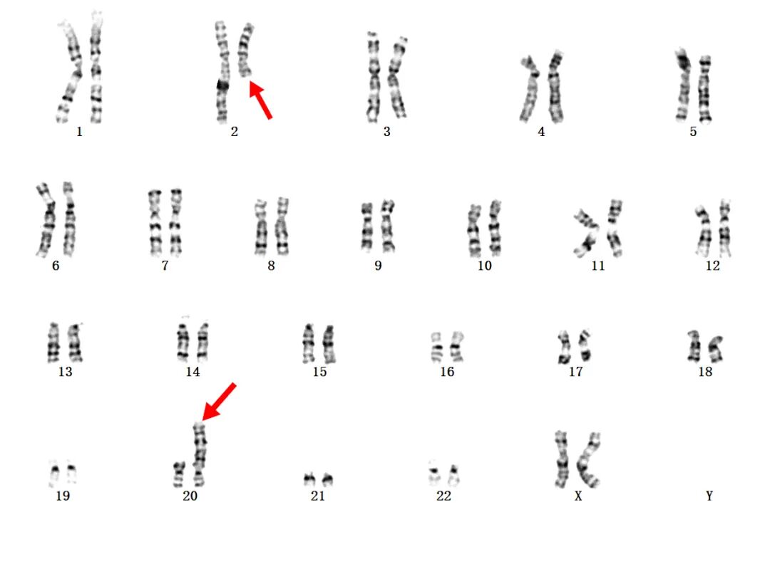 【协作组科普】反复流产?这份“错位”的爱,科学帮你摆正