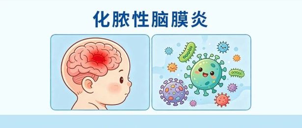 出生 1 天哭声异常！我院新生儿科成功救治母体 GBS 阳性重症化脓性脑膜炎新生儿