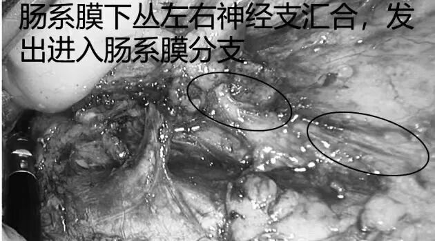 毫米精微解剖,守护盆腔神经功能|FTME功能性直肠根治术斩获淮安市一院2026年重大实用领先技术二等奖