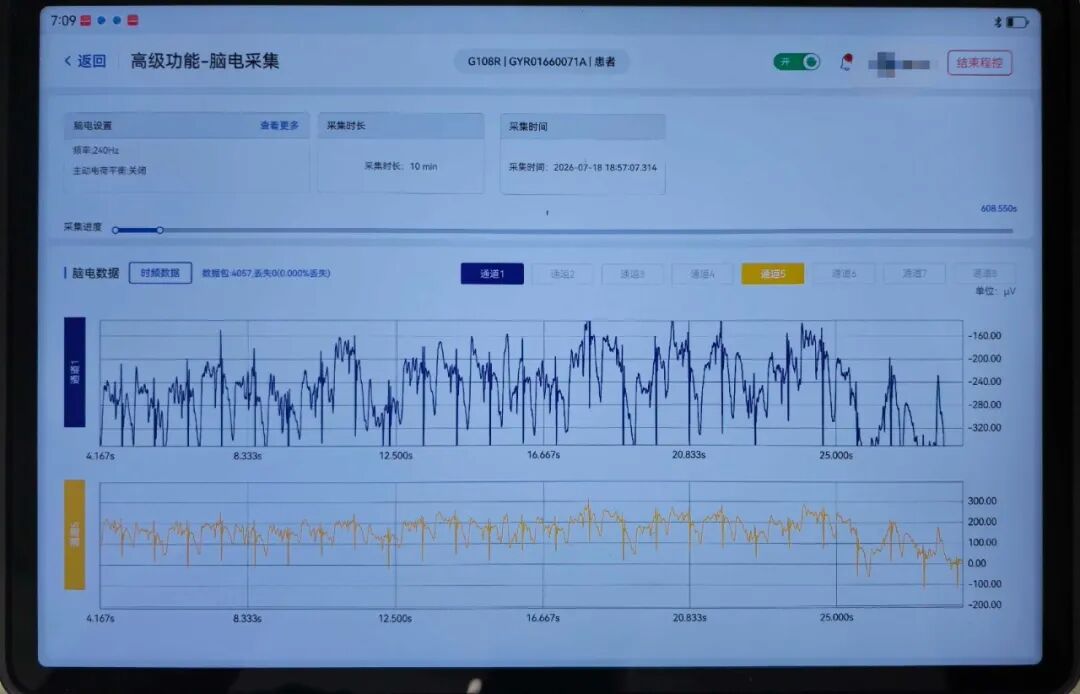 脑机融合,智能闭环!广西首例国产闭环脑深部电刺激手术在桂医大一附院完成