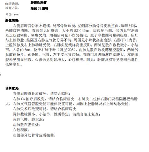 多学科诊疗 | 呼吸介入综合治疗连克两大呼吸致命急症