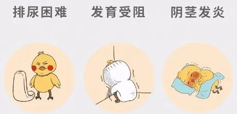 健康科普 | 暑假带娃割包皮?先等等!有一种情况千万别“一刀切”