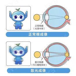 近视手术的“赠品”：散光居然能“买一送一”被消除？