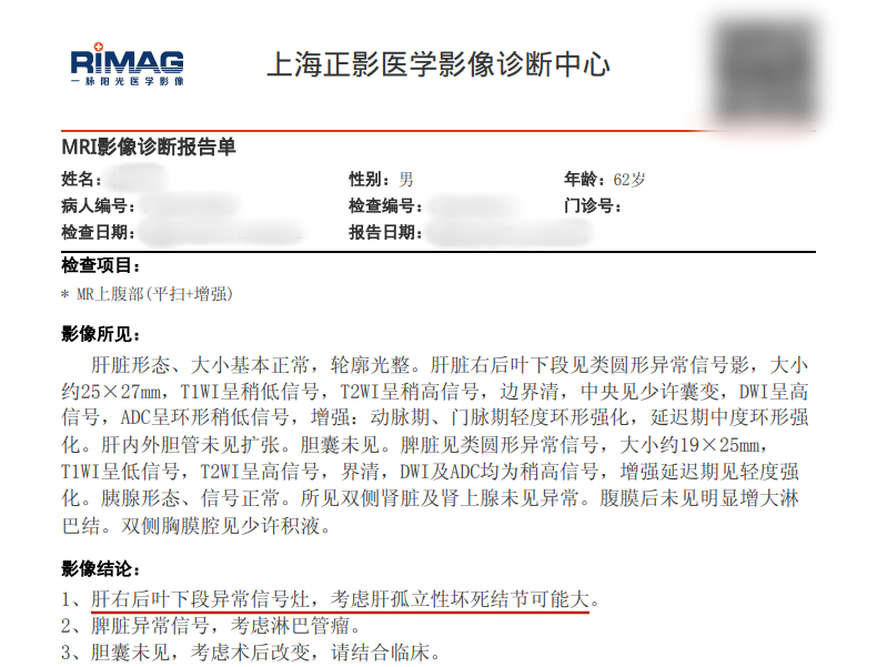 【案例分享】一例肝结节从“疑癌”到“良性”背后的精准抉择