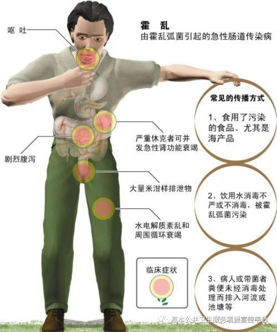 霍乱不是“普通拉肚子”!一文读懂高发季防控要点