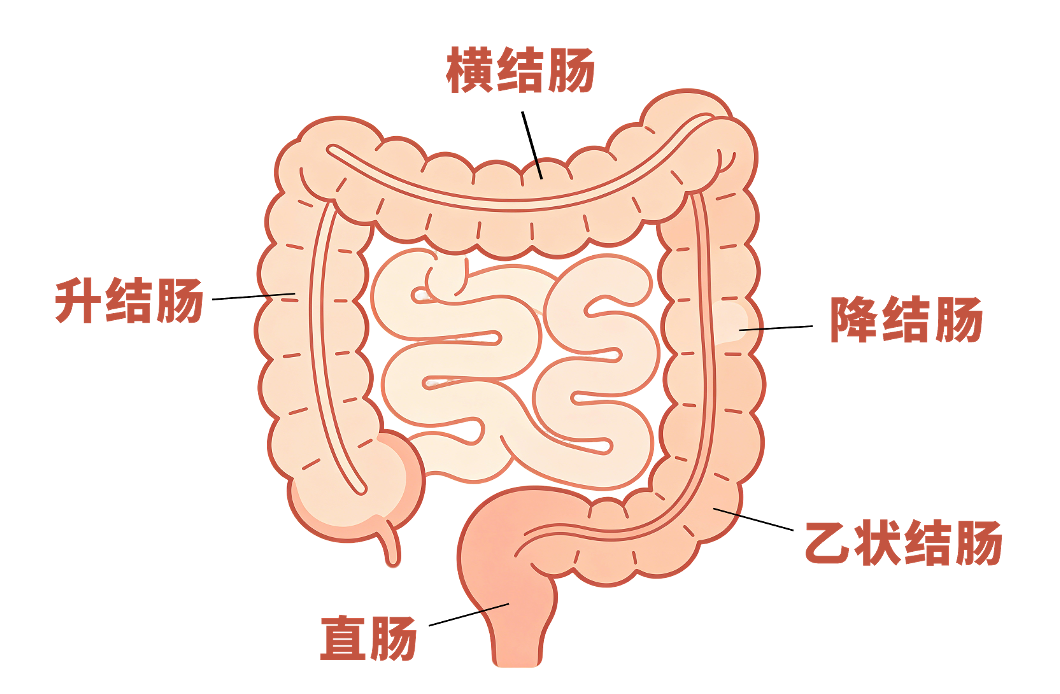 腹泻半年没当回事,一查竟是乙状结肠癌!台心医院胃肠外科精准微创除病灶