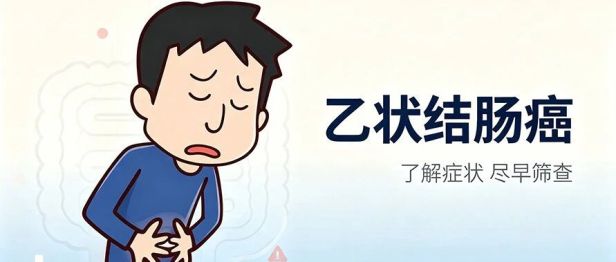 腹泻半年没当回事，一查竟是乙状结肠癌！台心医院胃肠外科精准微创除病灶