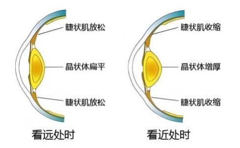 年纪不大就老花?规范养护延缓早期老花进展