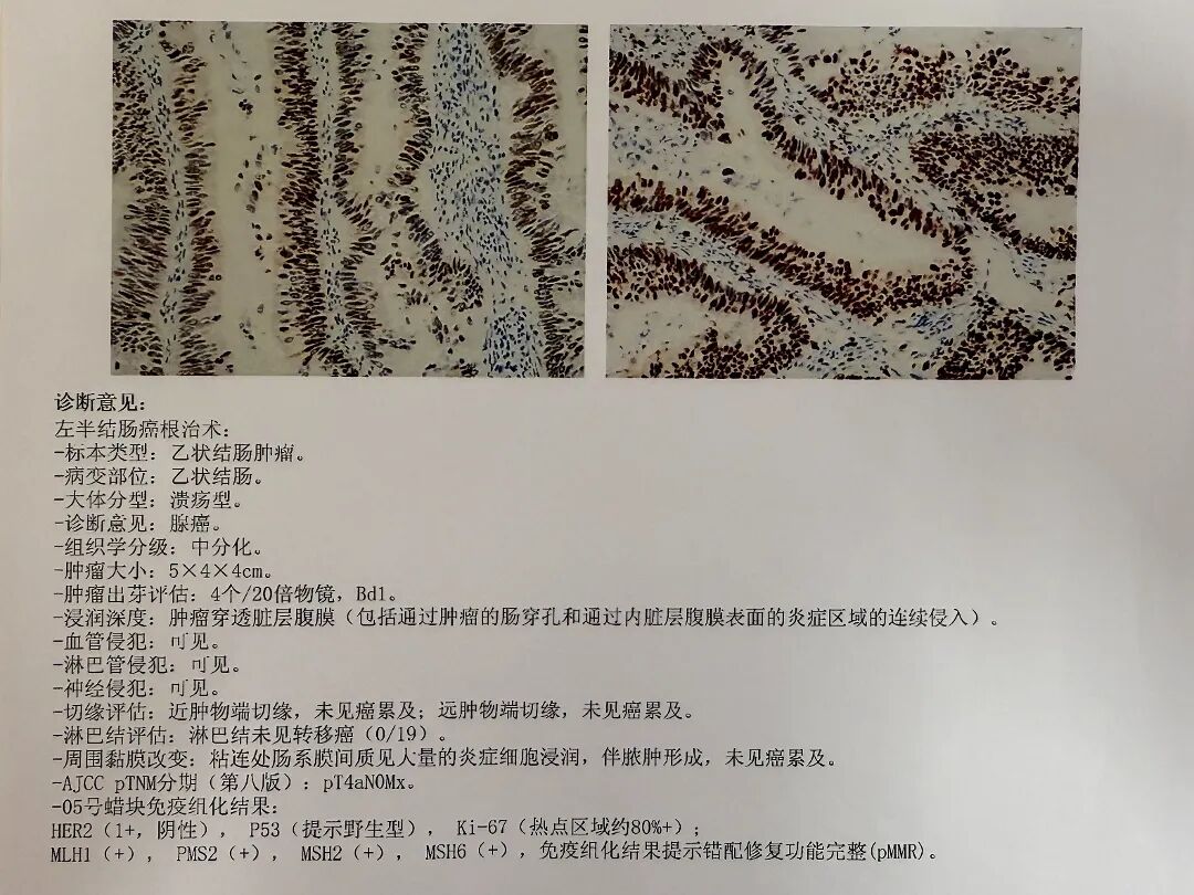 腹泻半年没当回事,一查竟是乙状结肠癌!台心医院胃肠外科精准微创除病灶