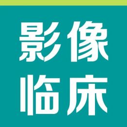 影像走进临床 | 唐光健教授赴遂川影像中心进行交流指导