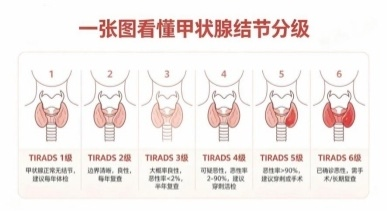 告别焦虑,护好脖子上的“生命蝴蝶”
