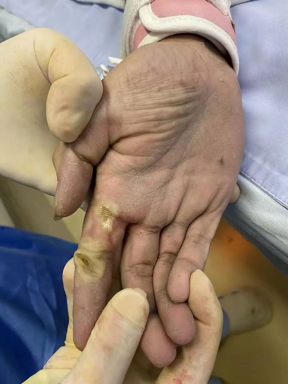 19岁小伙触电心跳停了，万幸有他们，救回来了！