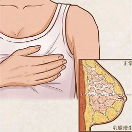 科普 | 彩超、X线、磁共振，到底该做哪个？乳腺检查最全科普来了！