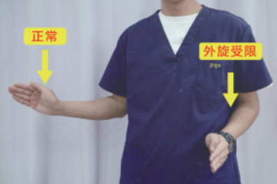 肩痛别乱甩！肩痛≠肩周炎！骨科专家教你分辨