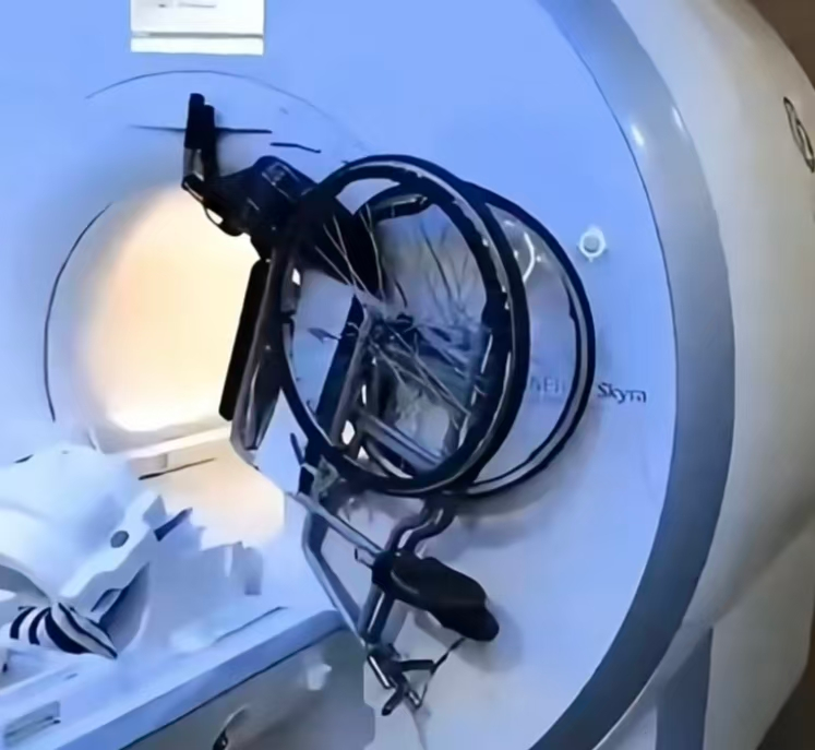 医生连内衣扣都不放过?核磁共振前的「搜身」是为啥→