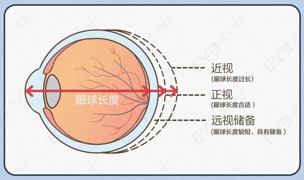 只给孩子查视力=白查!那查什么?家长一文吃透