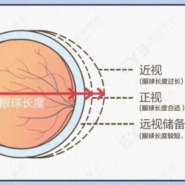 只给孩子查视力=白查！那查什么？家长一文吃透