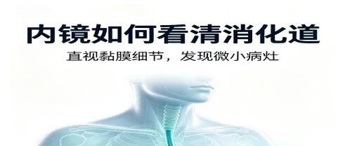内镜检查——打破大众最常见的三大误区