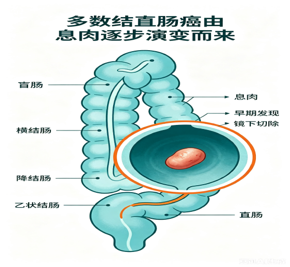内镜检查——打破大众最常见的三大误区