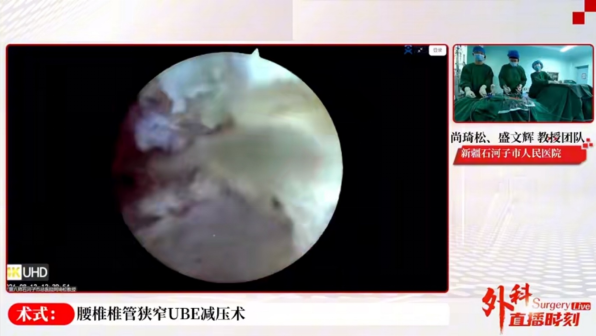 【科室动态】我院参加新疆康复医学会骨伤康复专业委员会暨中国脊柱UBE标准化技术推广联盟-新疆区域联盟2026年线上学术会议