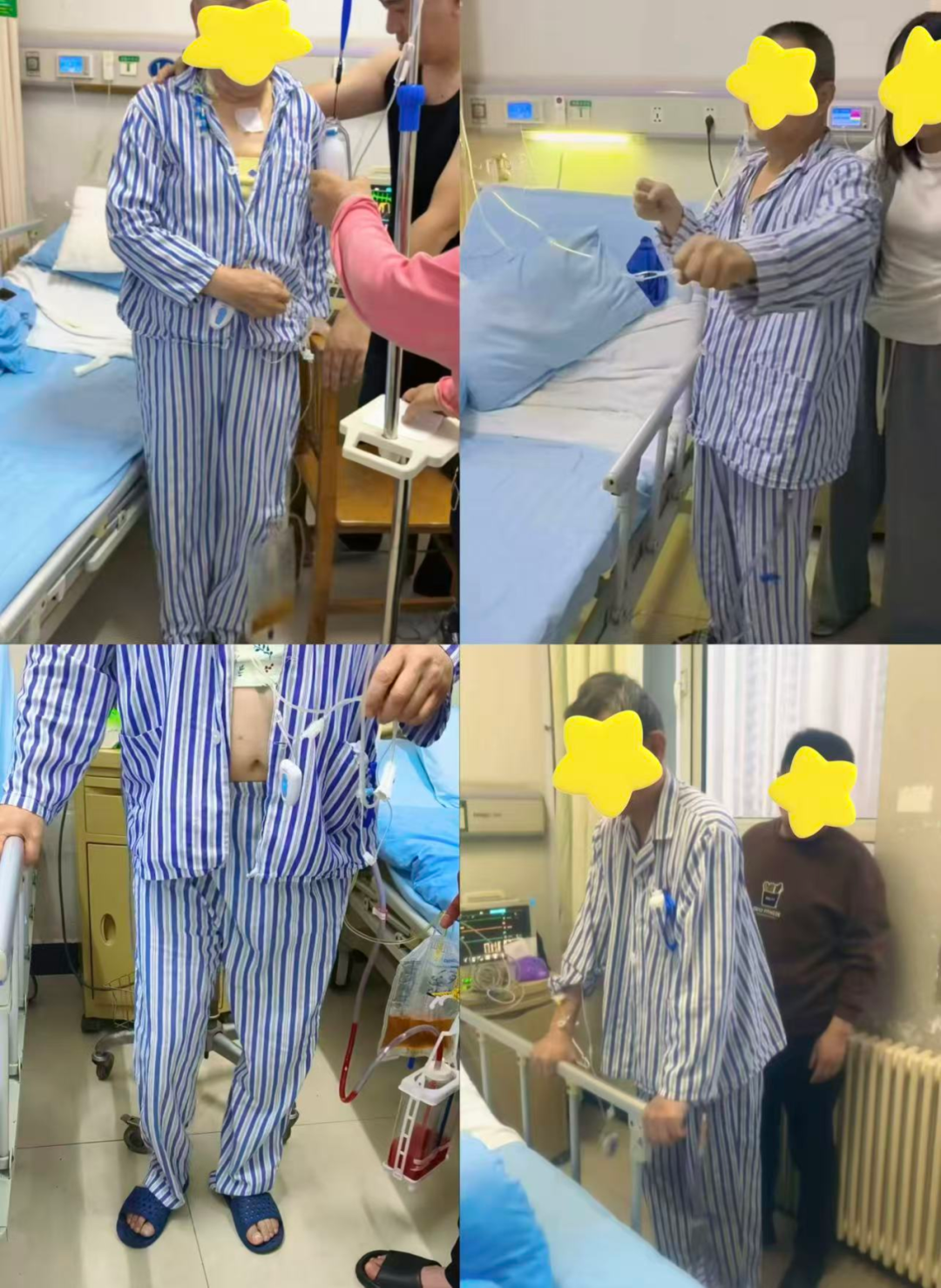科学康复，告别术后“久卧静养”