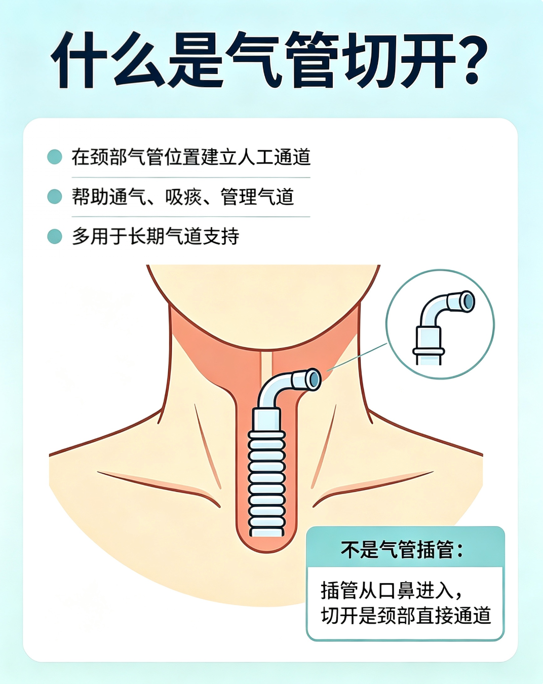 关于“气管切开”，您最担心的5个问题，一次说清！