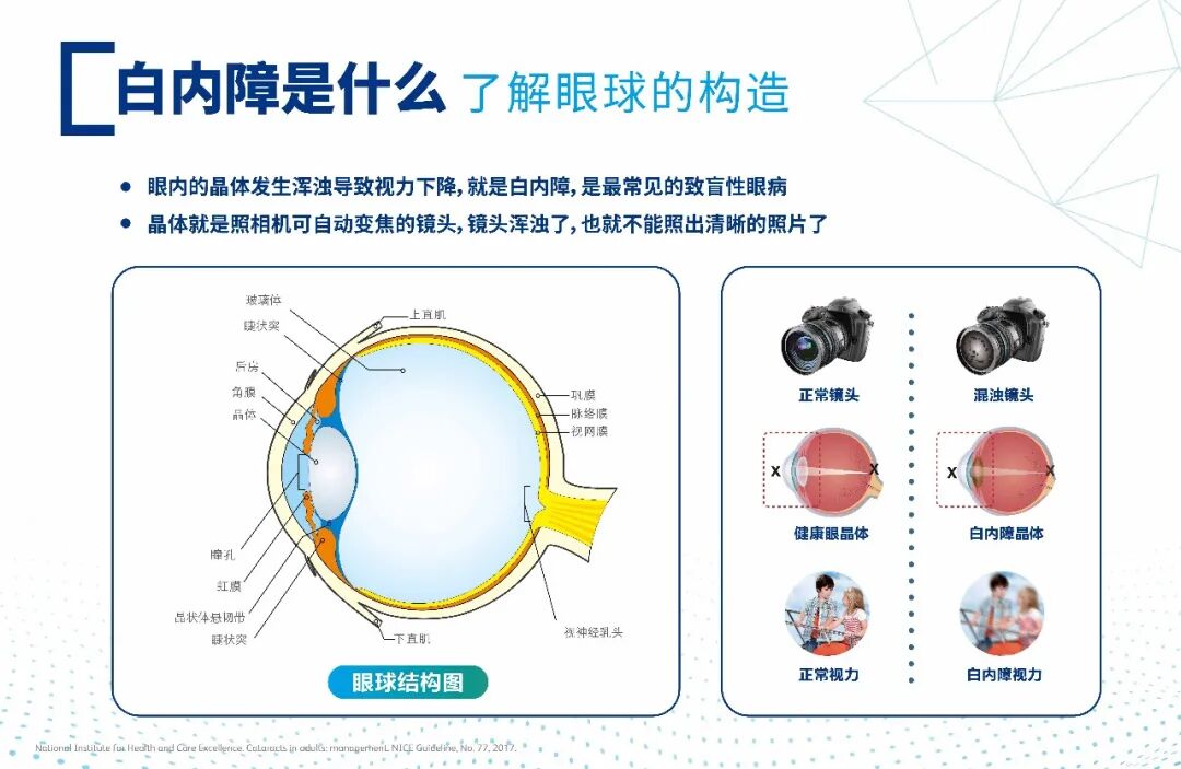 夏天不能做白内障手术?做了容易感染?