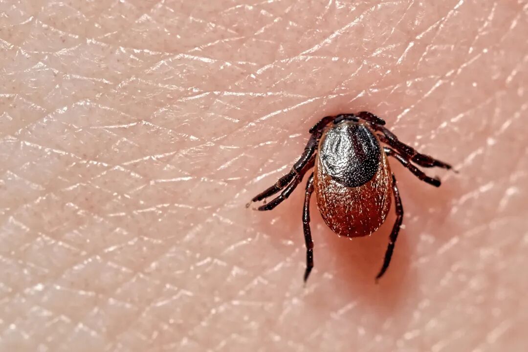 草原玩了一圈，回来烧到40℃，医生一句话问破防：接触过牛羊吗？