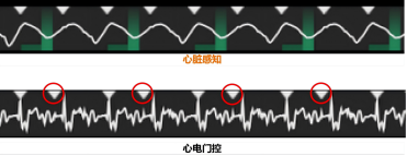 心脏MRI检查:为什么医生总让你“憋气、别心跳太快”?